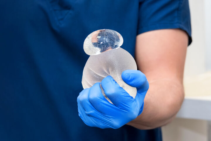 Moderni silikonski implanti sadrže čvrst gel i veoma čvrstu membranu koja štiti silikon od mehaničkih oštećenja