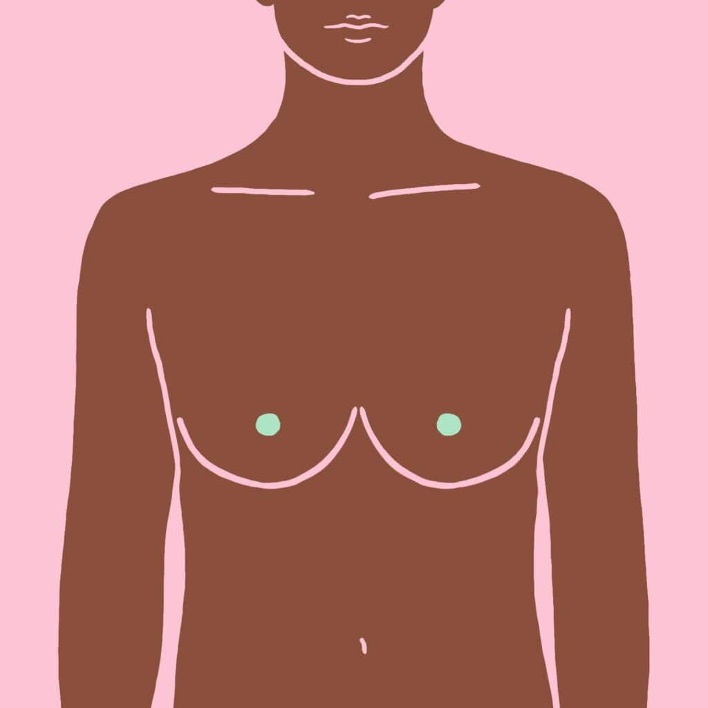 Oblik grudi kod žena sa izraženom mišićnom građom je atletski tip grudi