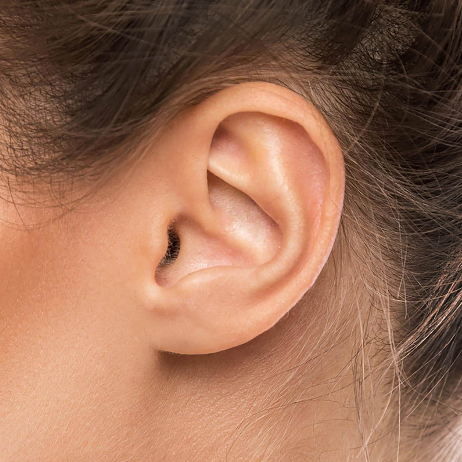 Operacija klempavih ušiju (korekcija ušiju)