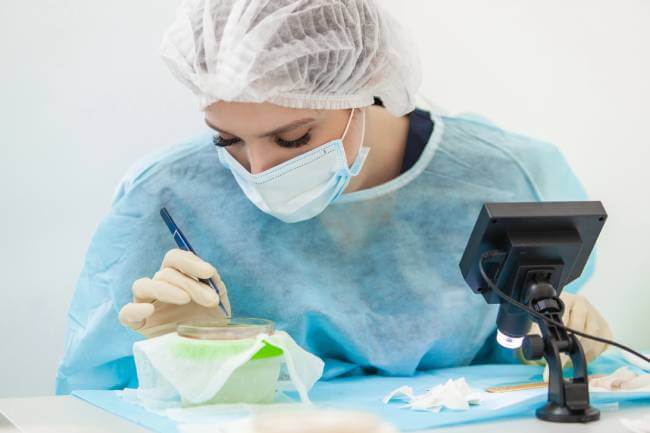 Transplantacija kose Beograd