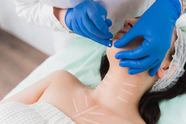 Silhouette soft niti za tretman mezonitima