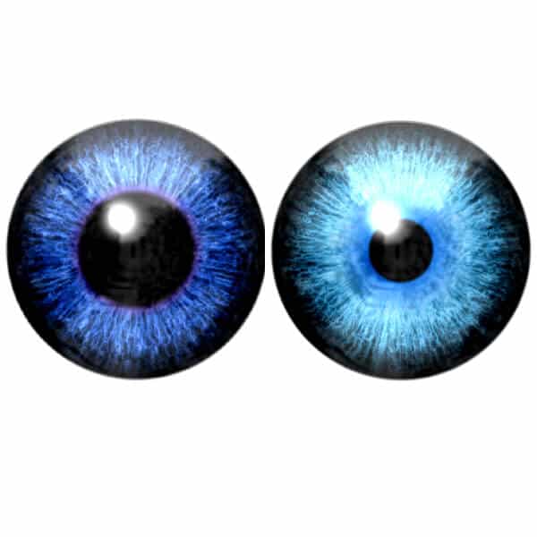 Okularni simptomi Hornerovog sindroma