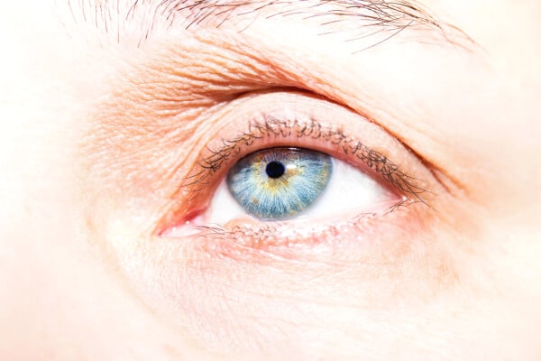 Glavna tri simptoma za Bernar-Hornerov sindrom