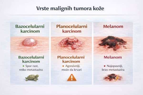 Maligni tumori na koži