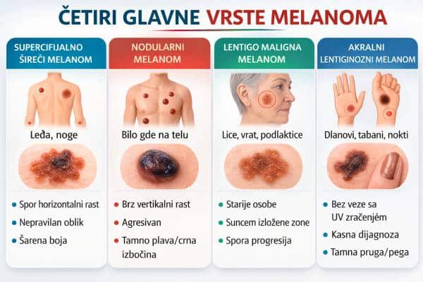 Melanom vrste