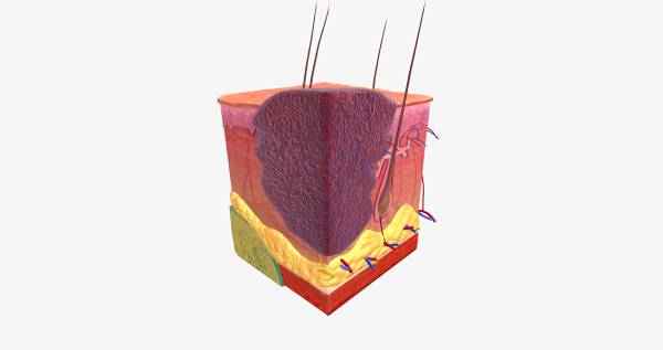 bazocelularni karcinom slike