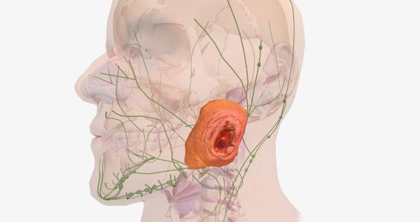 tipovi i vrste bazocelularnog karcinoma