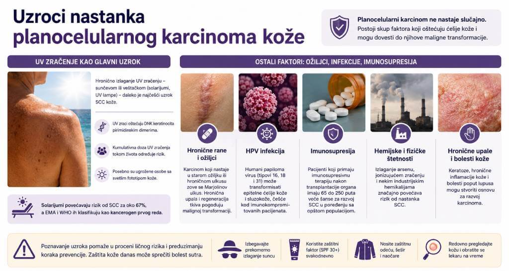 UV zračenje i drugi faktori rizika za planocelularni karcinom kože
