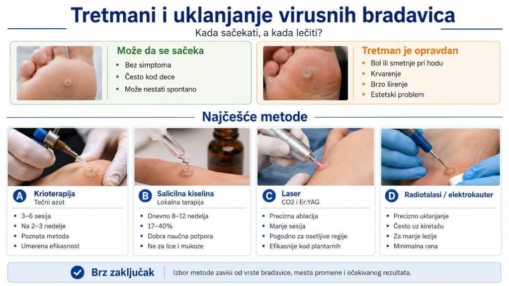 tretmani i uklanjanje virusnih bradavica krioterapija salicilna kiselina laser radiotalasi