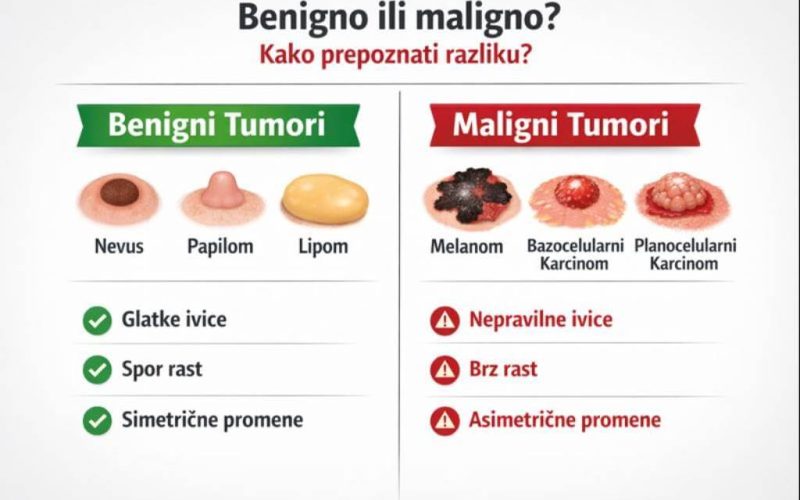 Benigni i maligni tumori na koži
